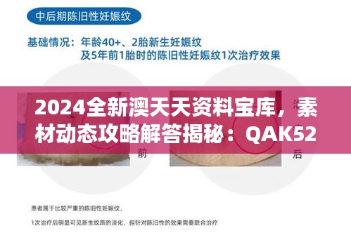 2024全新澳天天资料宝库，素材动态攻略解答揭秘：QAK520.71