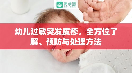 幼儿过敏突发皮疹，全方位了解、预防与处理方法