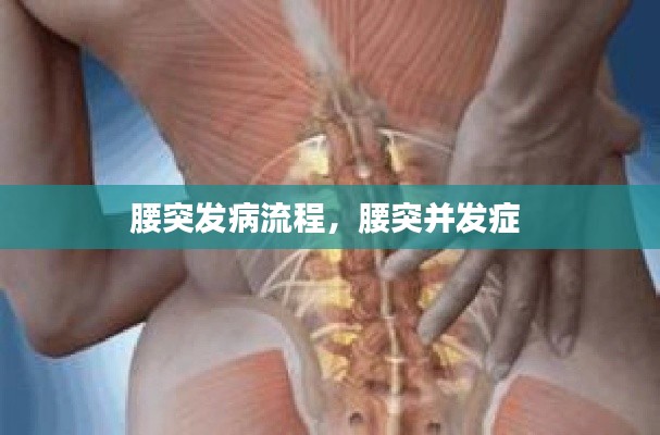 腰突发病流程，腰突并发症 