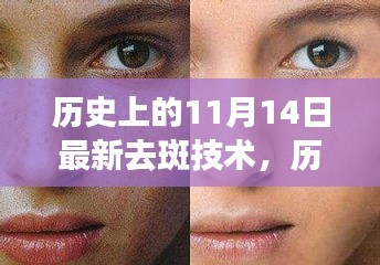 历史上的11月14日，最新去斑技术照亮人生，重塑自信与成就感之路