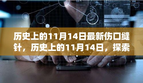 历史上的11月14日，伤口缝针技术的诞生与发展探索