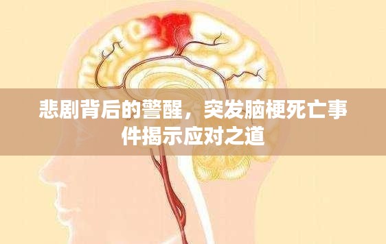 悲剧背后的警醒，突发脑梗死亡事件揭示应对之道