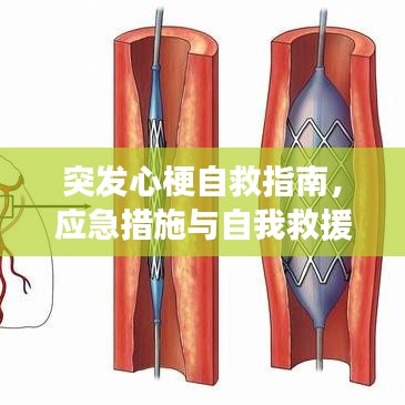 突发心梗自救指南，应急措施与自我救援方法